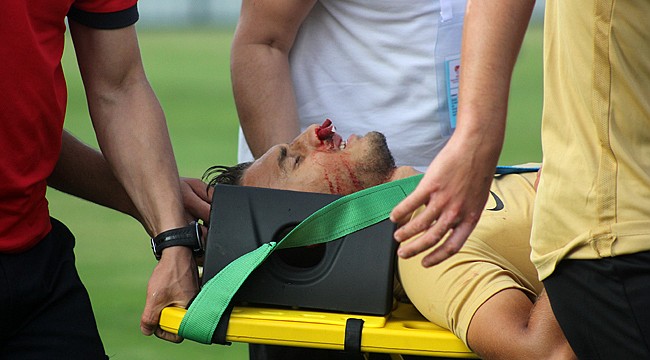 Çaykur Rizesporlu futbolcunun maçta burnu kırıldı