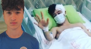 Rizesporlu futbolcu beyin travması geçirdi