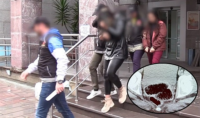 Rize'de uyuşturucuyu bağırsaklarında saklayan 2 yabancı uyruklu kadın tutuklandı