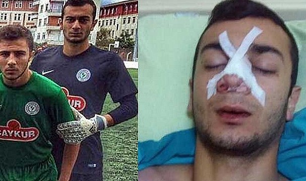 Rizesporlu kalecinin maçta burnu kırıldı